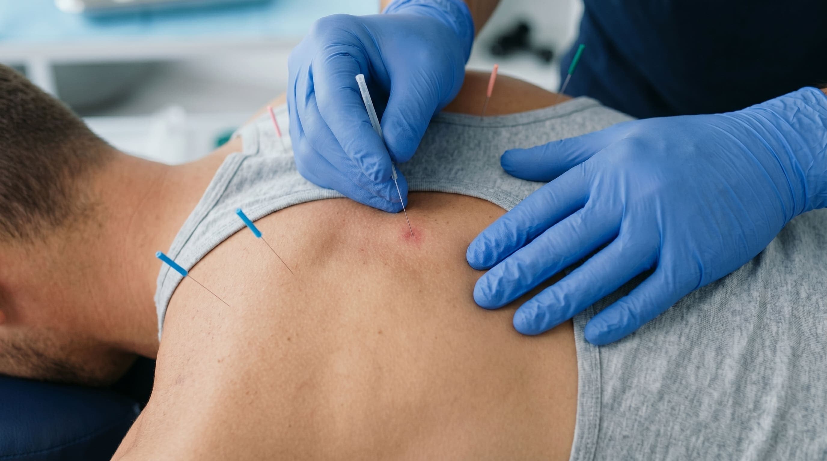 Dry Needling & Trigger Point Therapy
